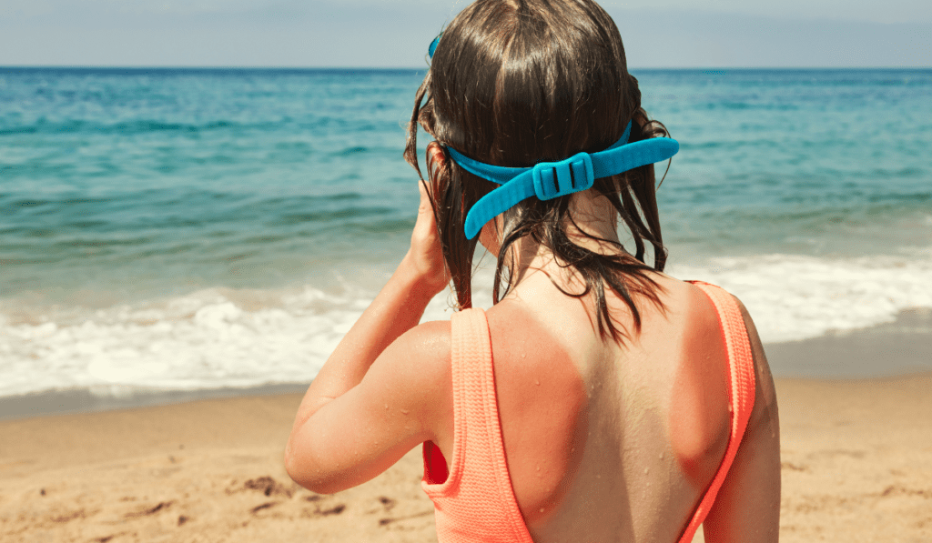 sun exposure and harmful UV rays